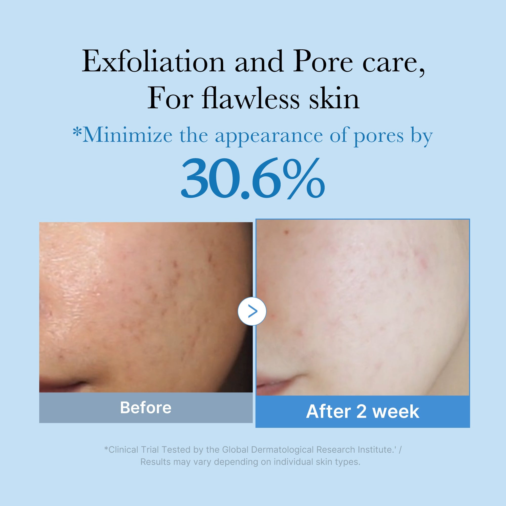 Zero Pore Toner A7