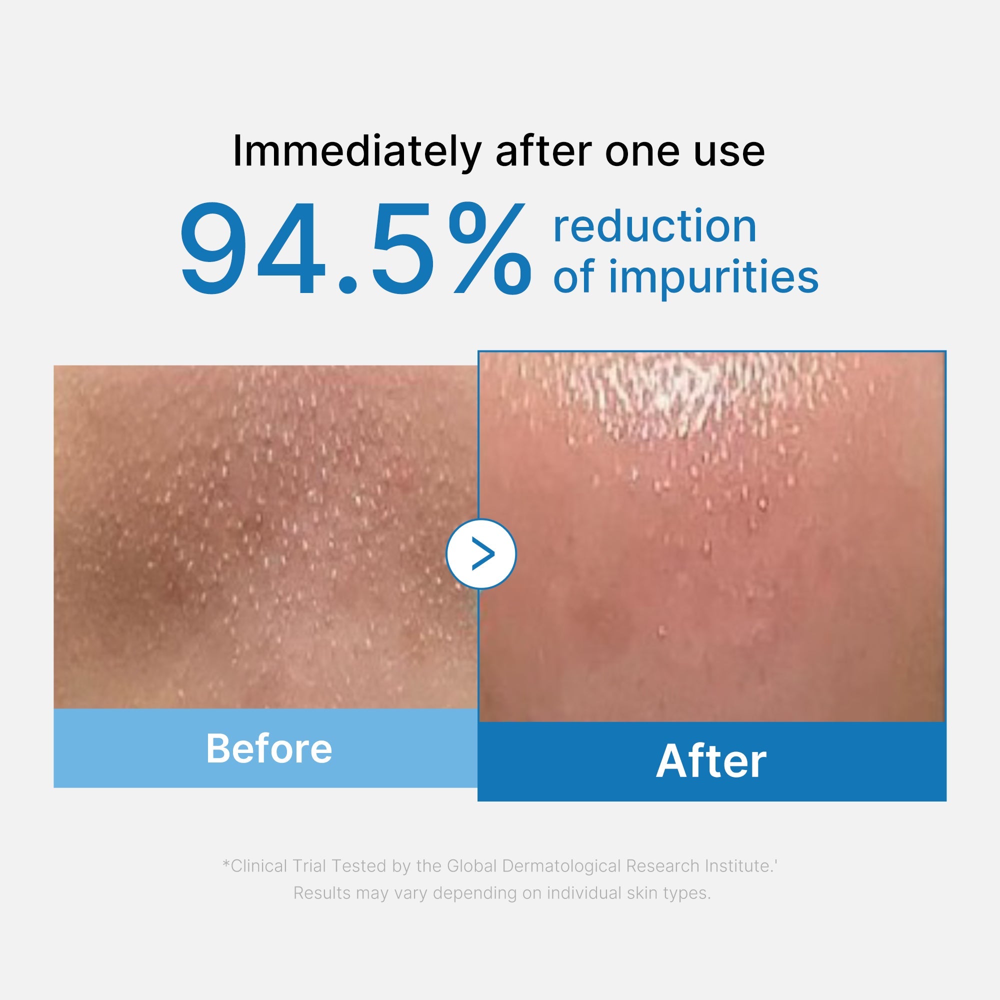 Zero Pore Blackhead Deep Cleansing Oil G3