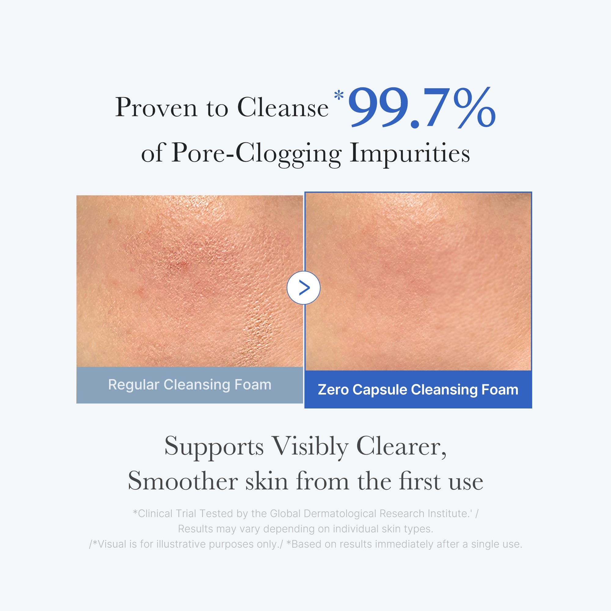 Zero Pore Capsule Cleansing Foam H7