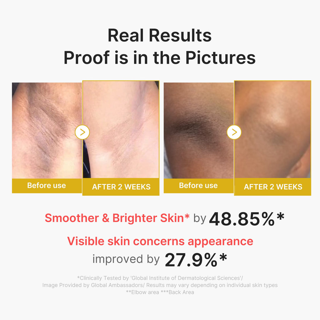 Kojic Acid Turmeric Body Peel Shot U5