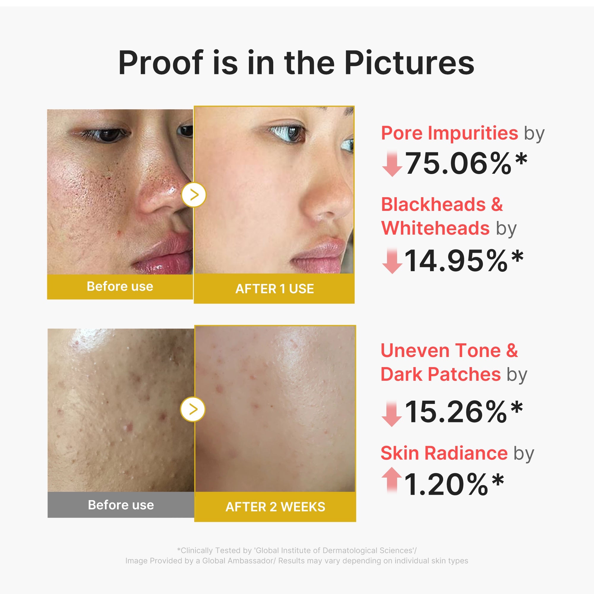 Kojic Acid Turmeric Peel Shot D5