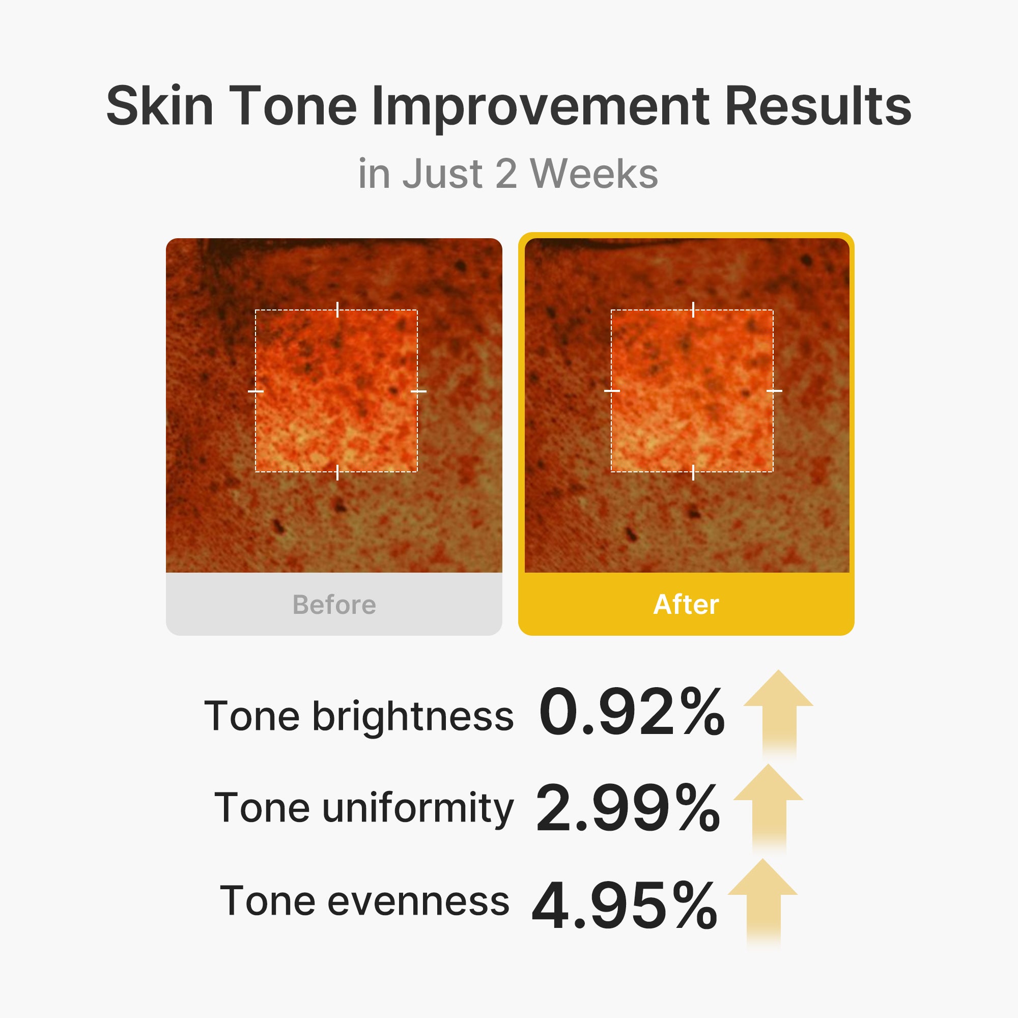 Kojic Acid Turmeric Vita Capsule Cream L9