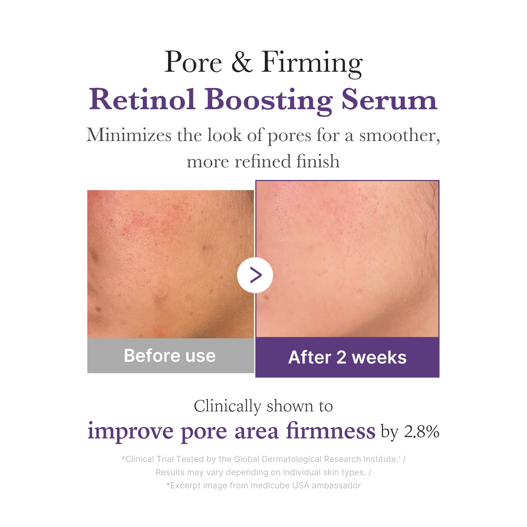 Retinol NMN Boosting Serum K7