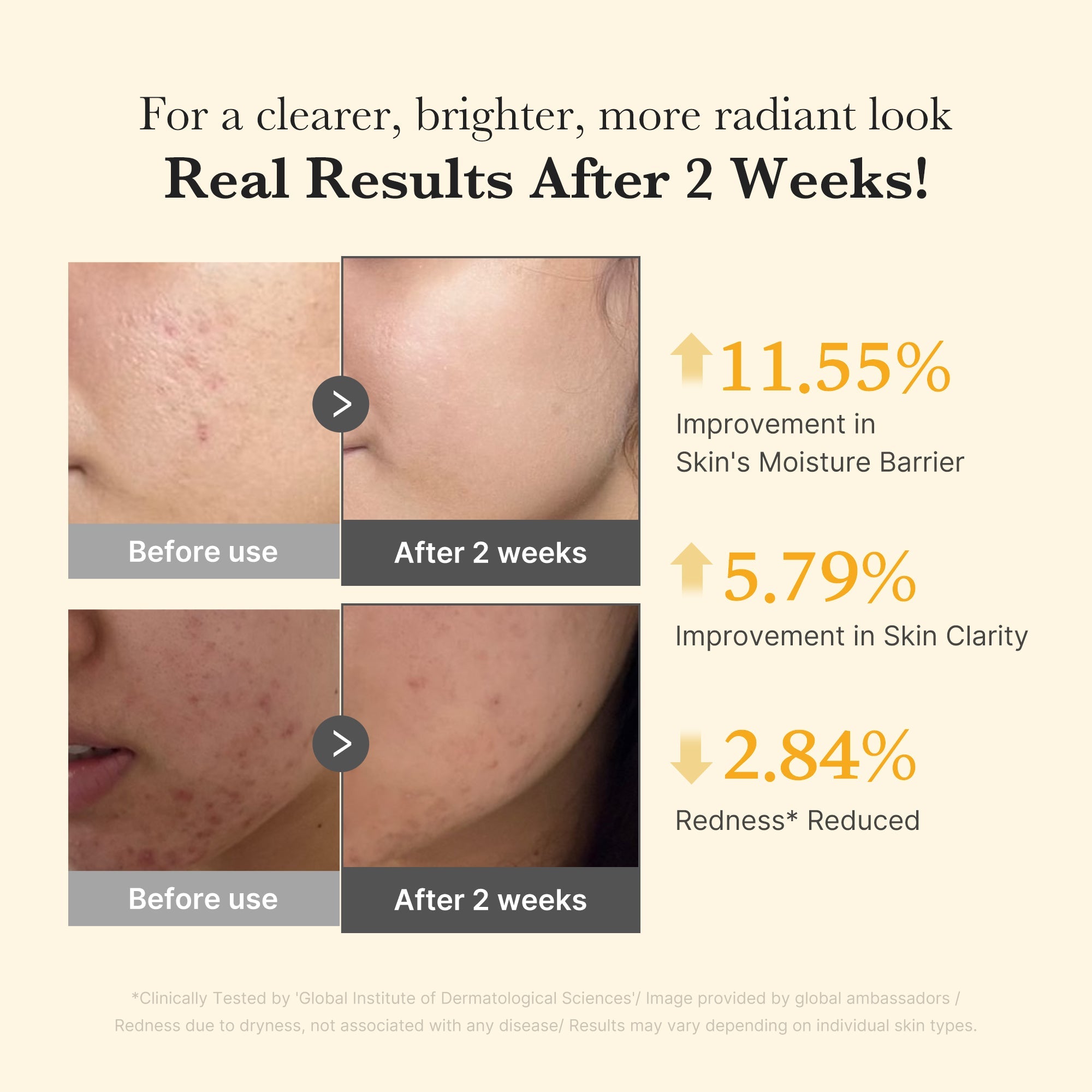 Kojic Acid Turmeric Capsule Serum Y8