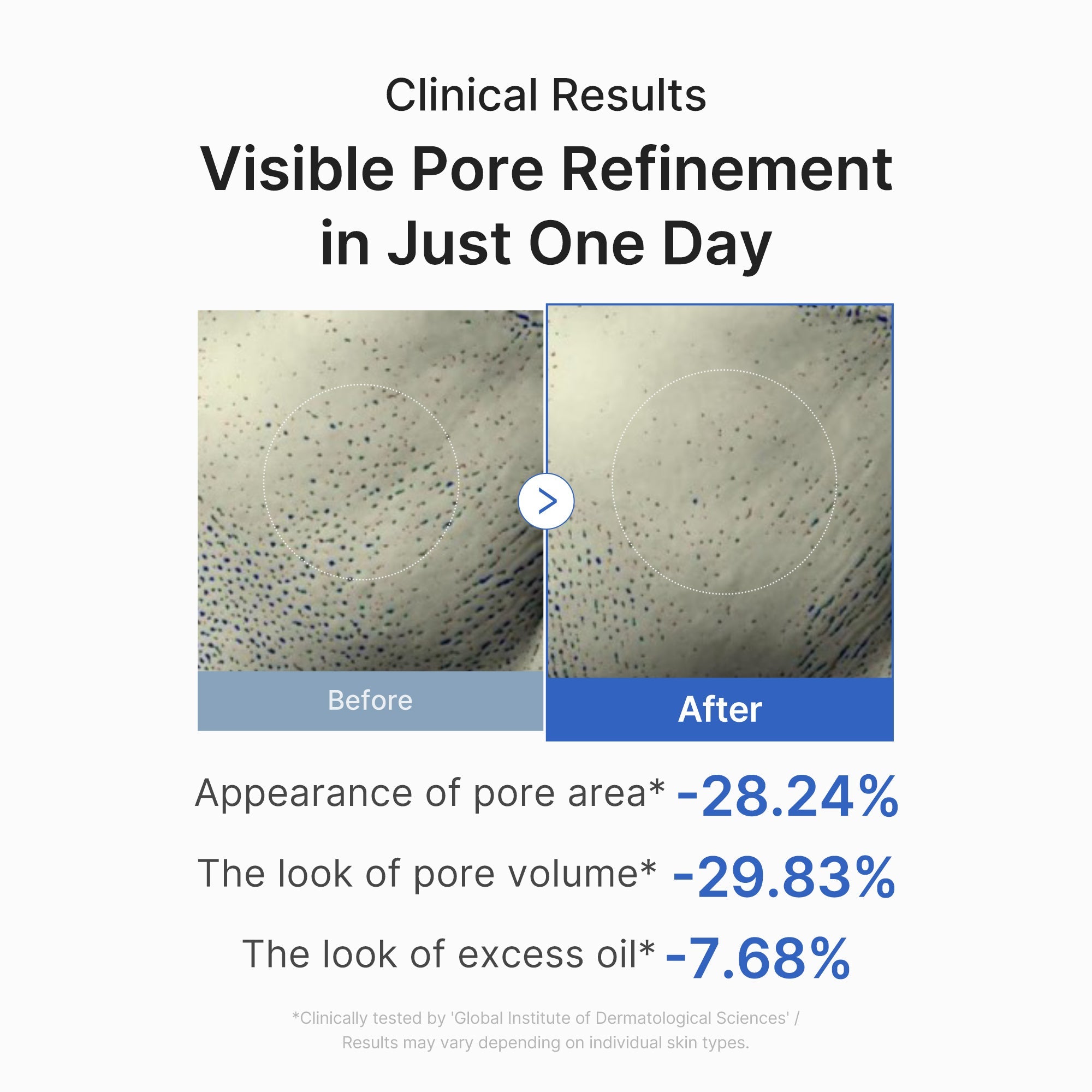 Zero Pore One-day Peptide Serum M9