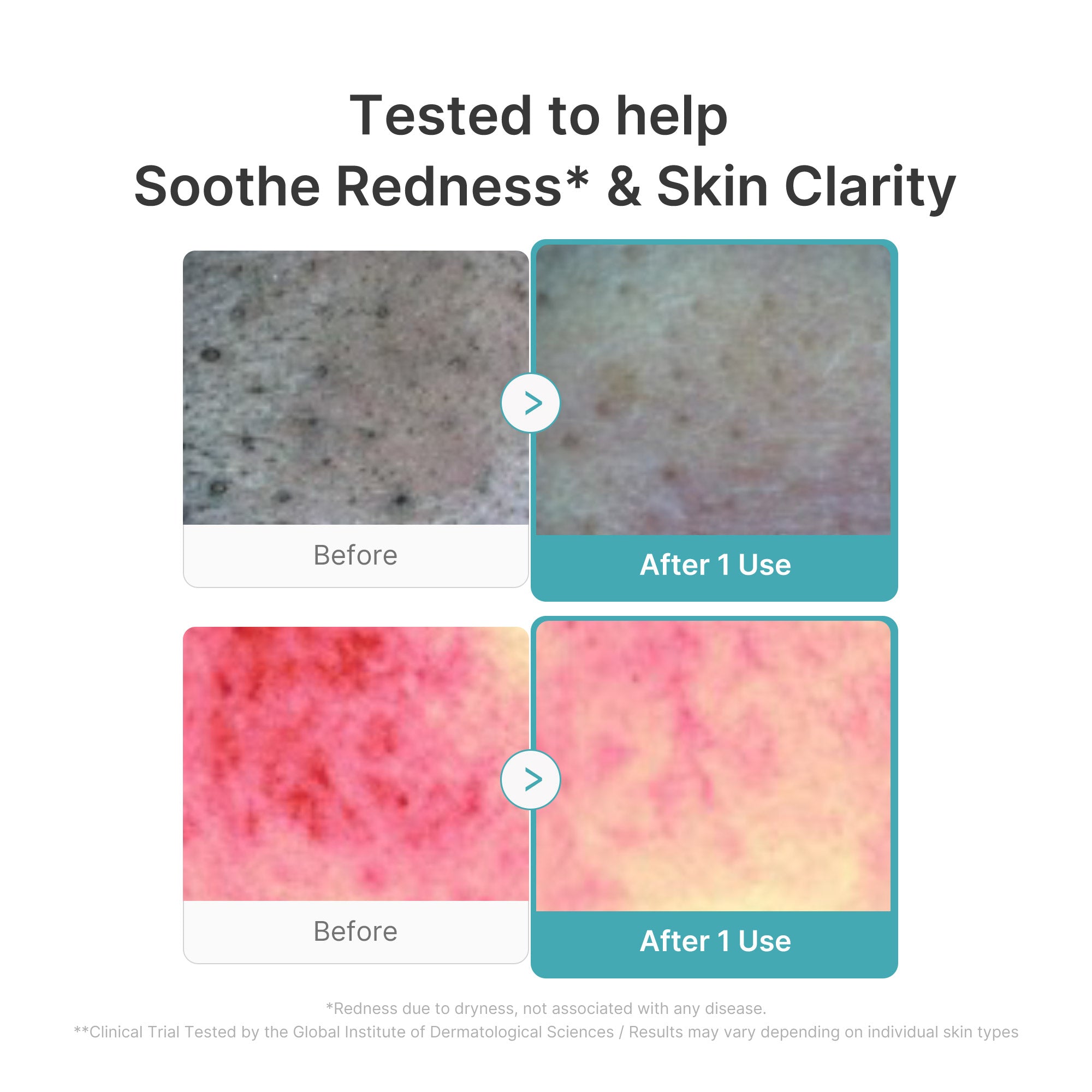 Azelaic Acid Capsule Foam Cleanser W3