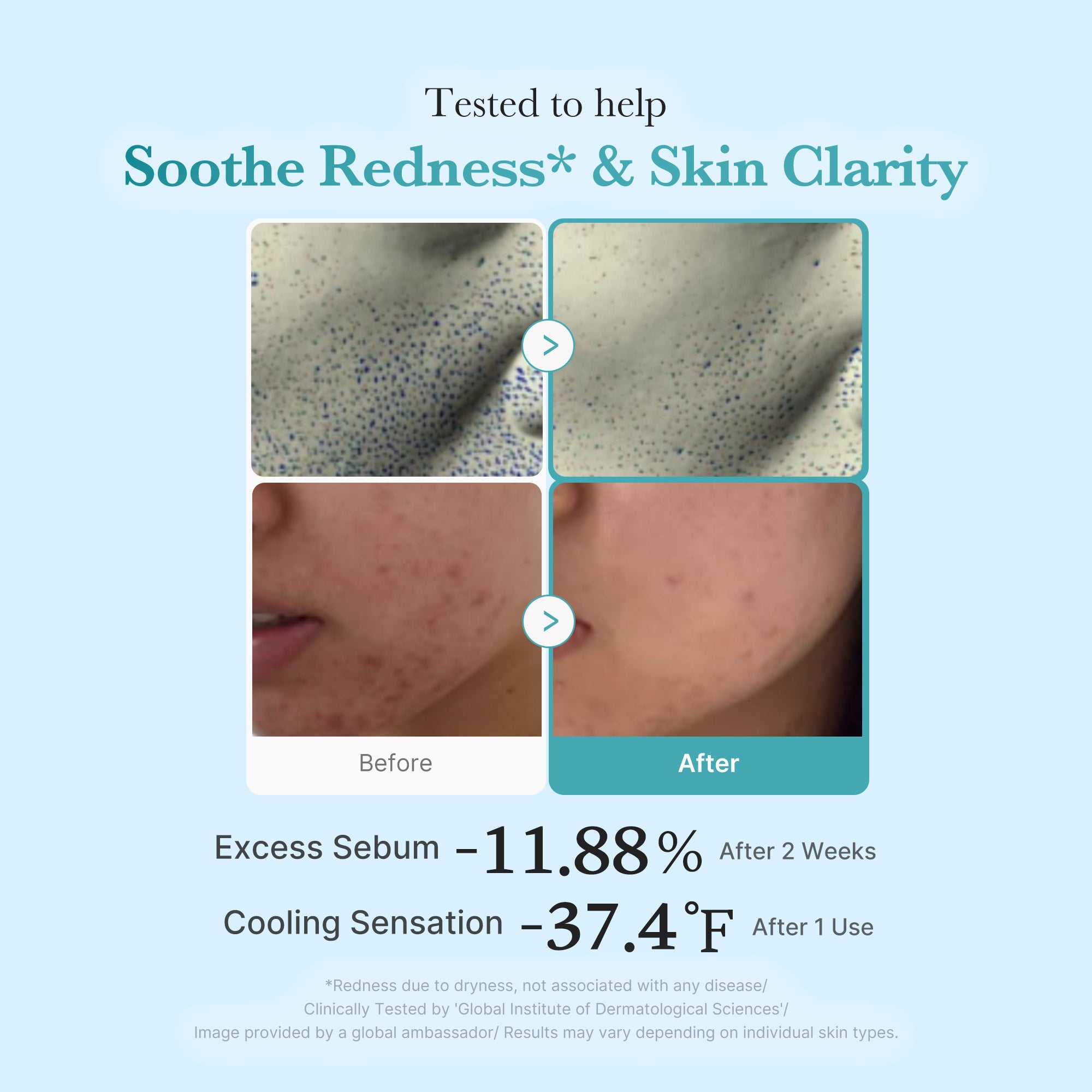 Azelaic Acid Niacinamide Clarifying Toner N1