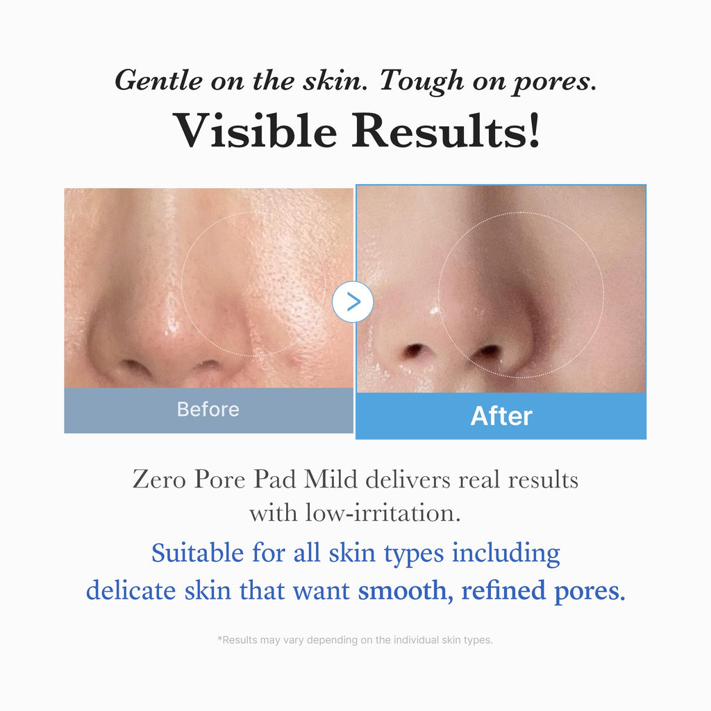 Zero Pore Madecassoside Pads (Mild) G3