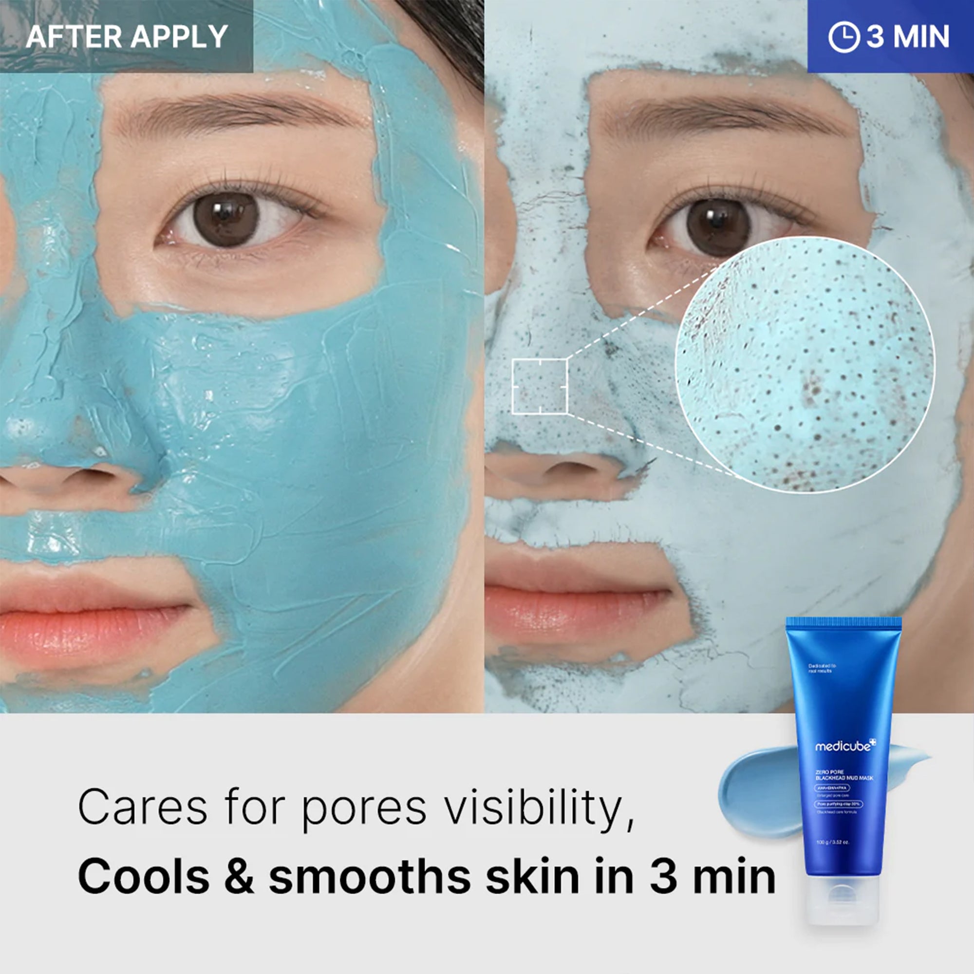 Zero Pore Blackhead Mud Mask U1