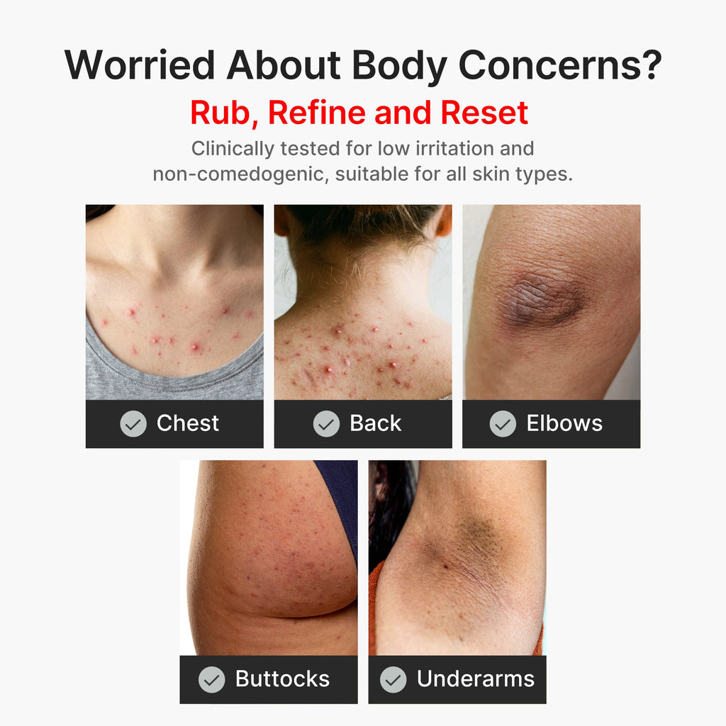 Kojic Acid Turmeric Body Peel Shot U5