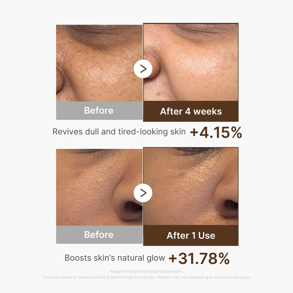 Deep Vitamin C Capsule Serum I3
