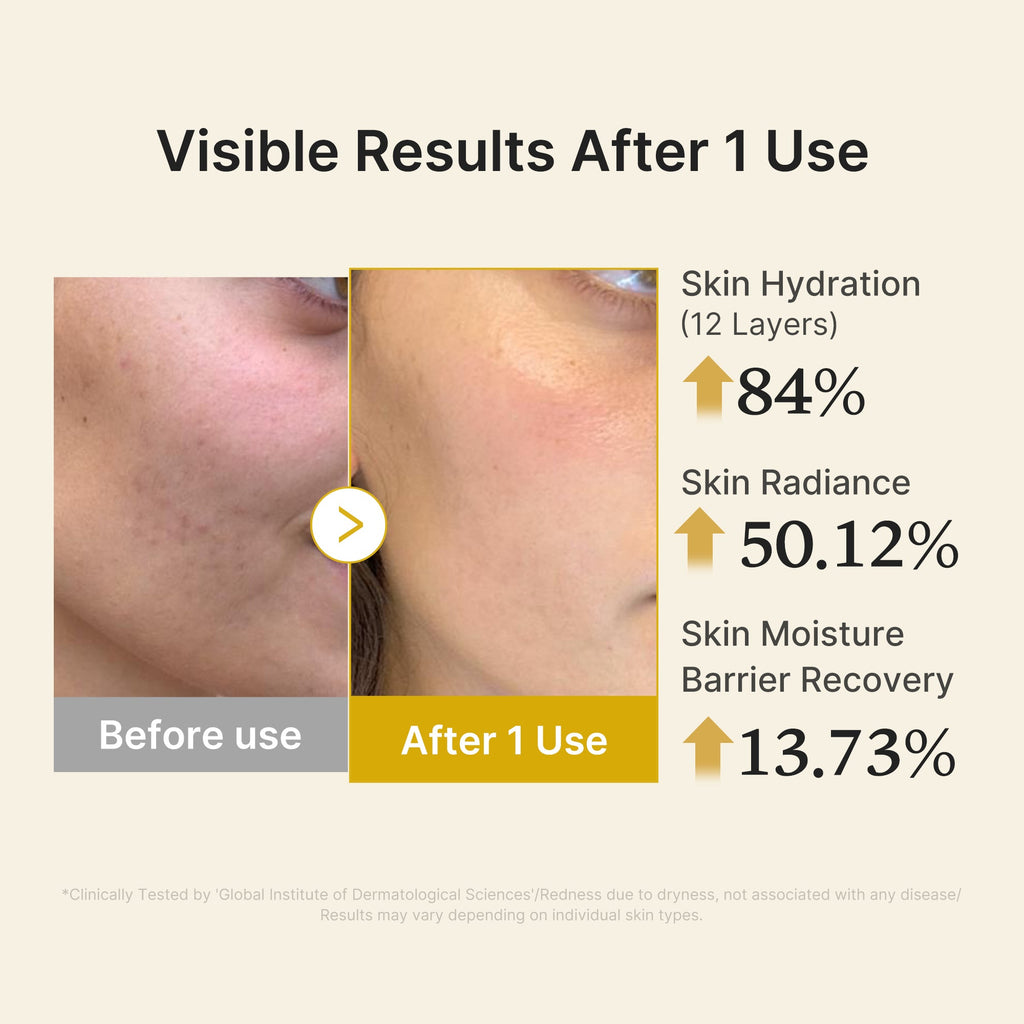 Kojic Acid Turmeric Vitamin Gold Jelly Mist Serum K3