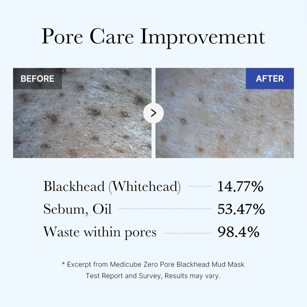 Zero Pore Blackhead Mud Mask I1