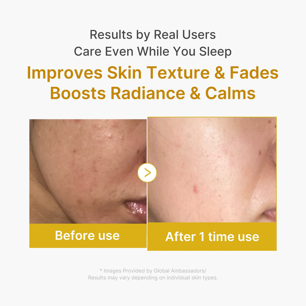 Kojic Acid Turmeric Overnight Wrapping Mask O5