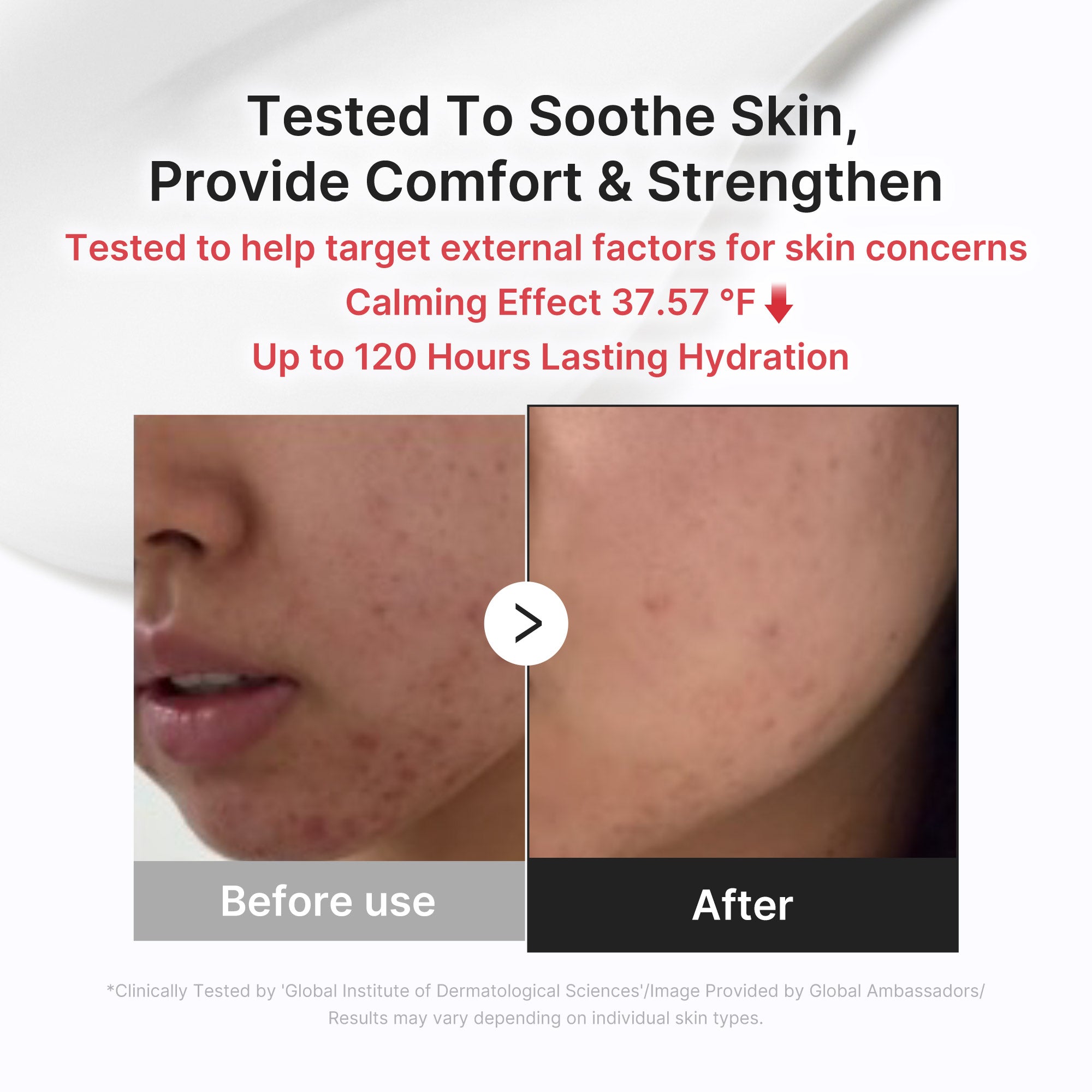 3H Daily Relief Cream Q1