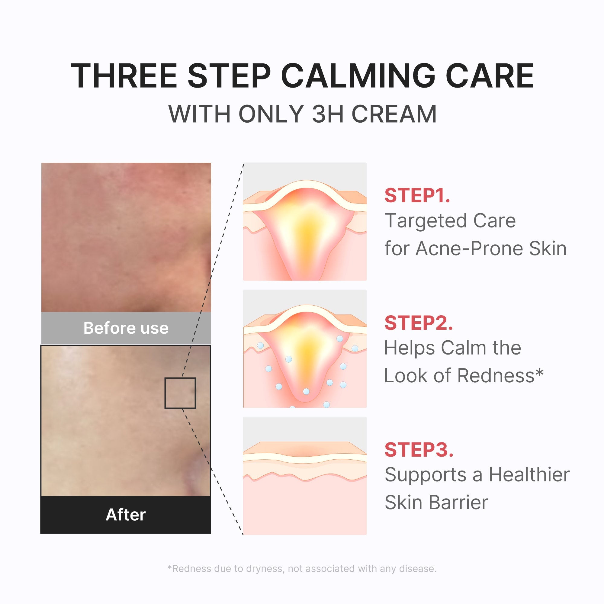 3H Daily Relief Cream Q1