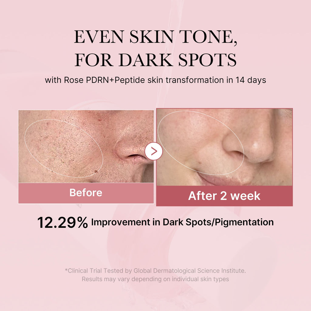 PDRN Pink Peptide Toner U5