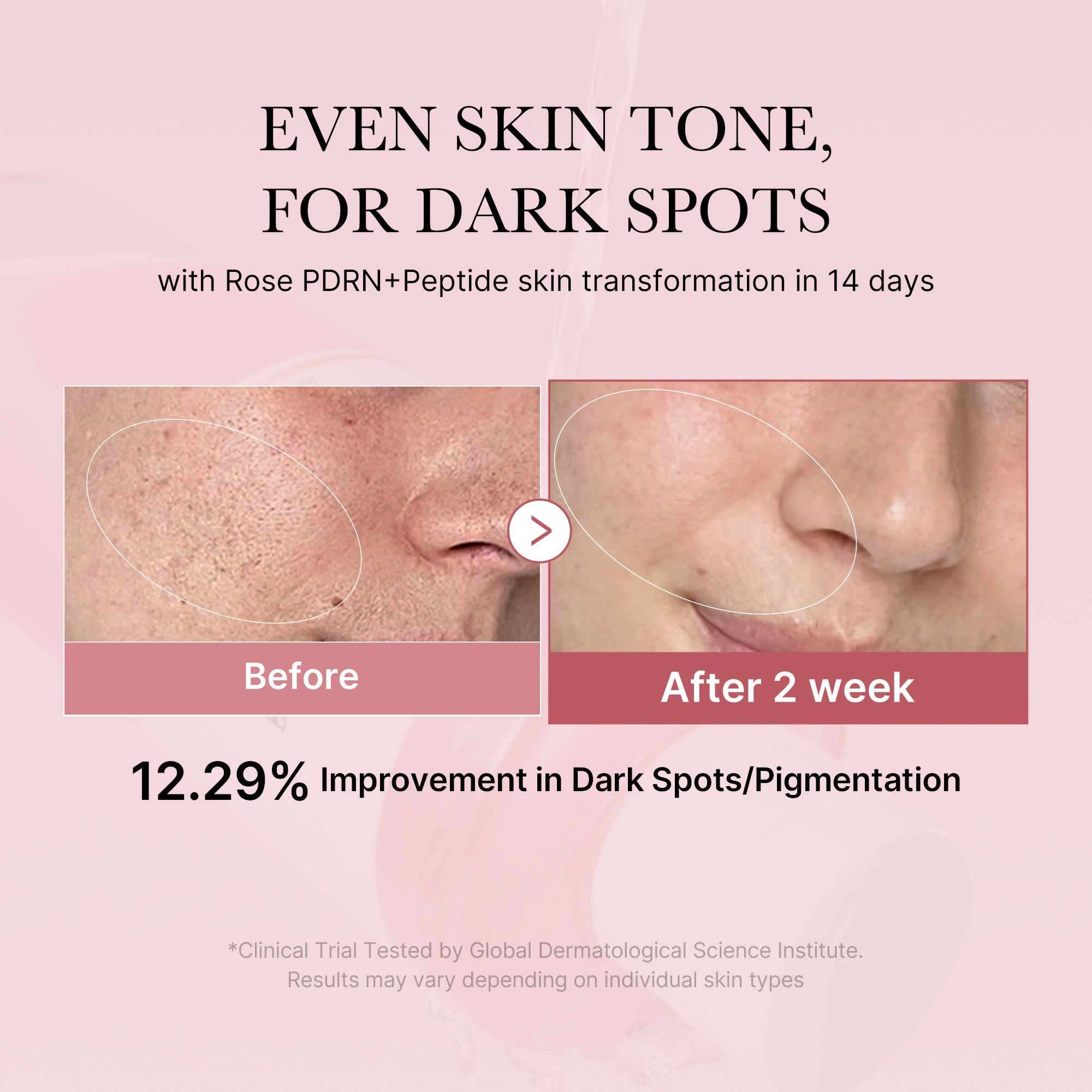 PDRN Pink Peptide Toner U5