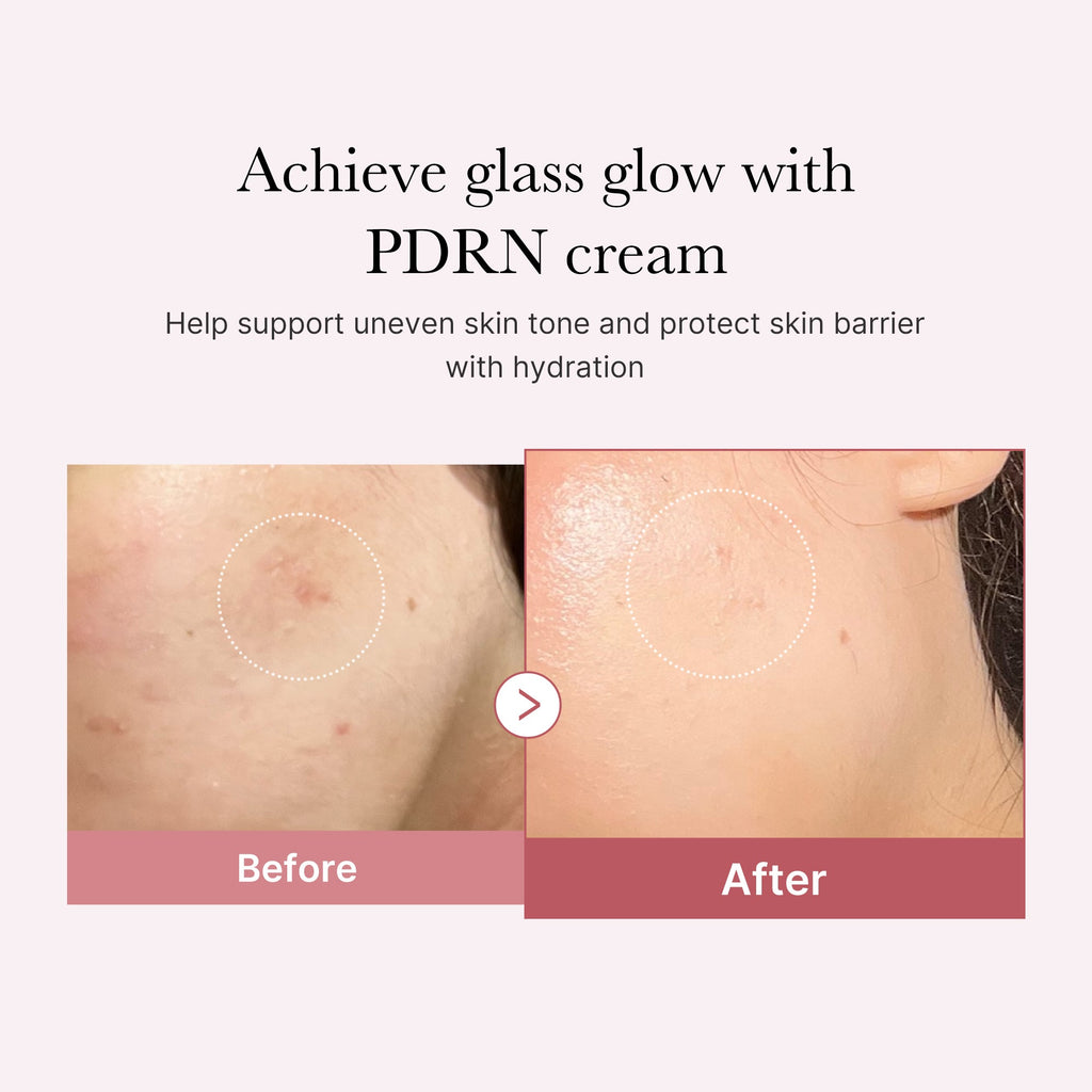 PDRN Pink Peptide Cream H9