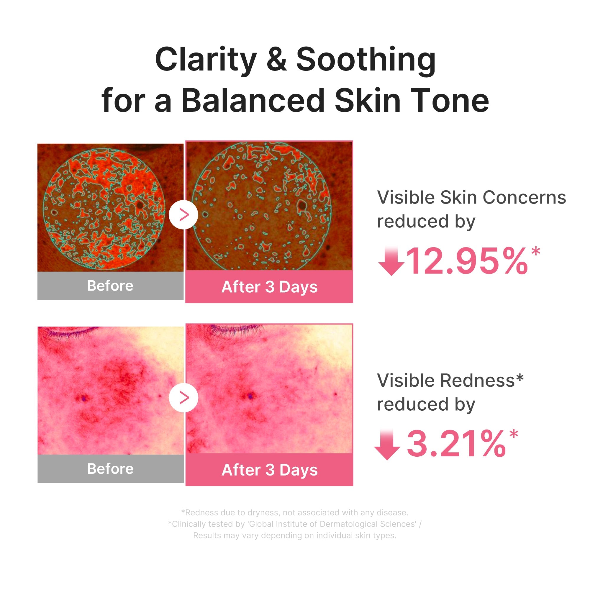 Ultra Light PDRN Pink Peptide Serum U8