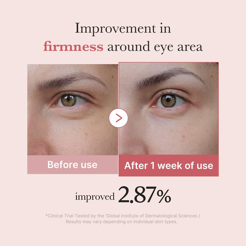 PDRN Pink Peptide Eye Cream J1