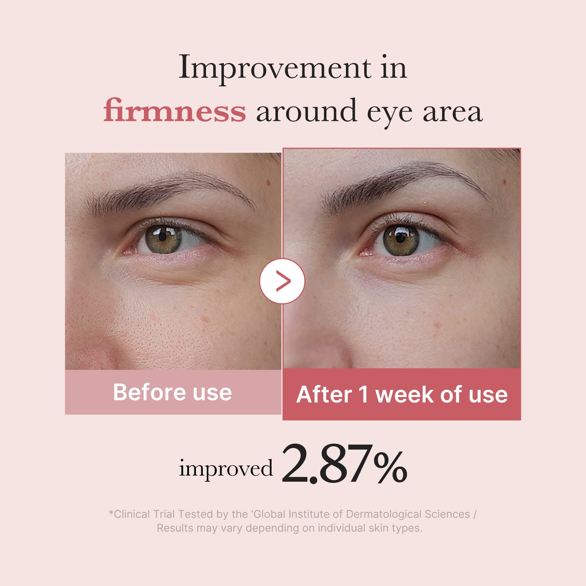 PDRN Pink Peptide Eye Cream J1