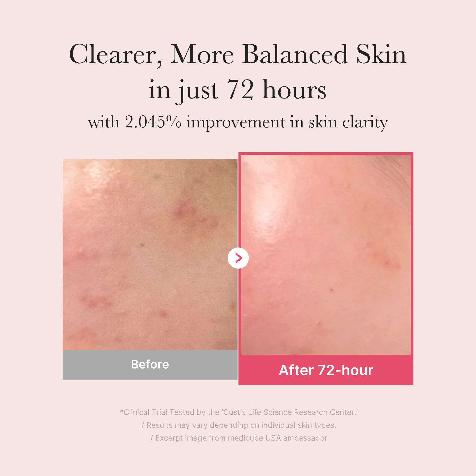TXA Niacinamide Serum S5