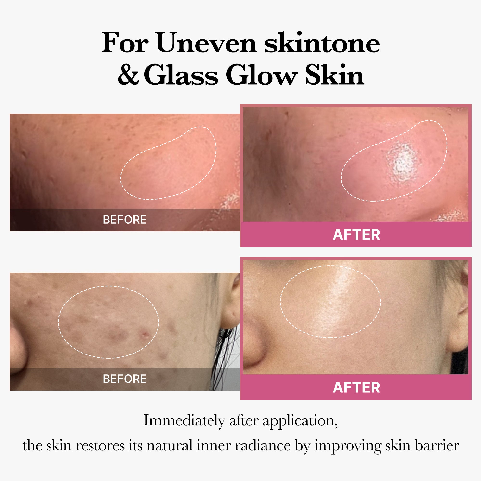 [Tati's Exclusive] Plump Perfection Set P3